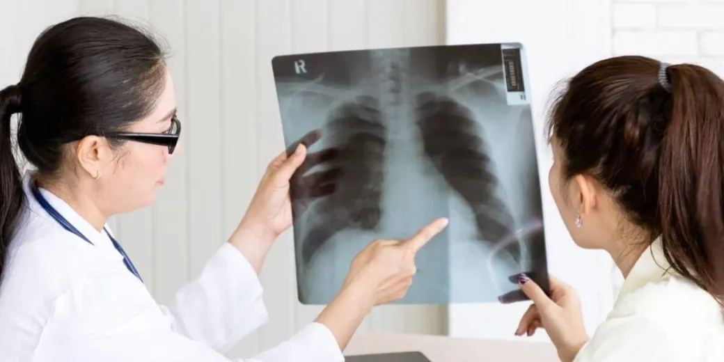 lung cancer screening