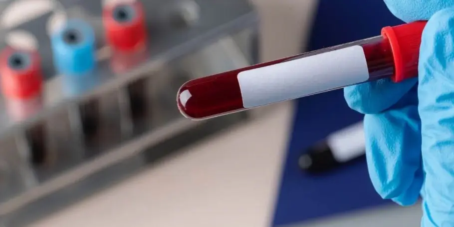 blood tests to suspected pulmonary embolism