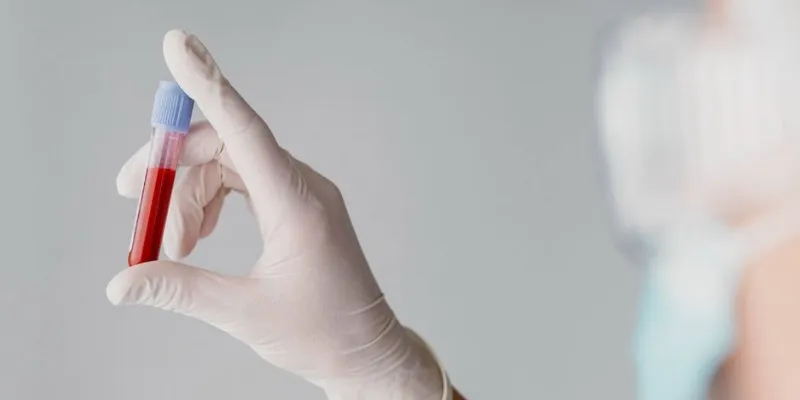 blood tests to diagnose gastritis blood tests to diagnose gastritis