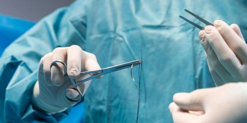 preventing recurrent hernias